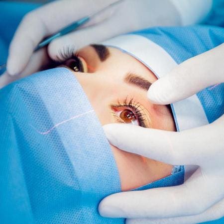 Cataract Surgery